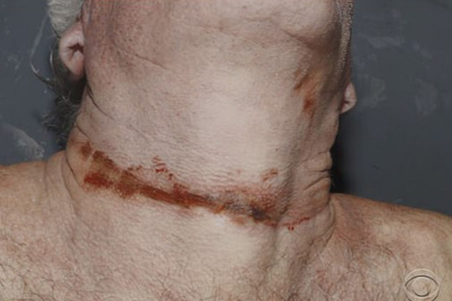 Suicídio de Jeffrey Epstein