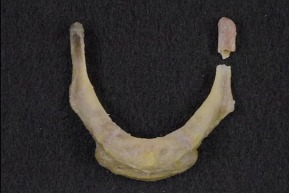 Suicídio de Jeffrey Epstein