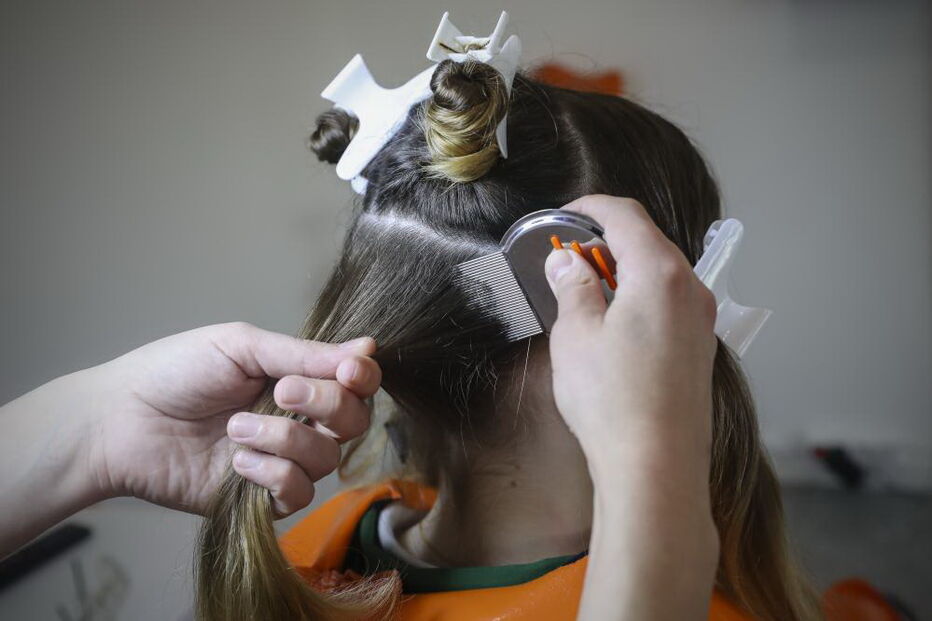 Clínicas de tratamento para piolhos cheias de adolescentes contagiadas em 'selfies'