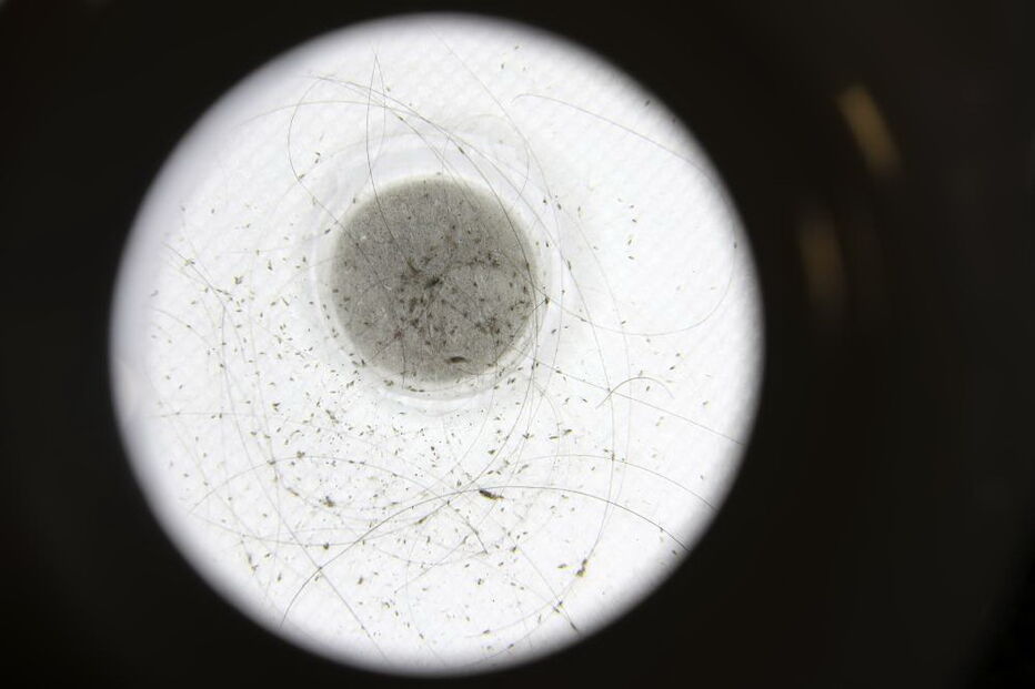 Clínicas de tratamento para piolhos cheias de adolescentes contagiadas em 'selfies'