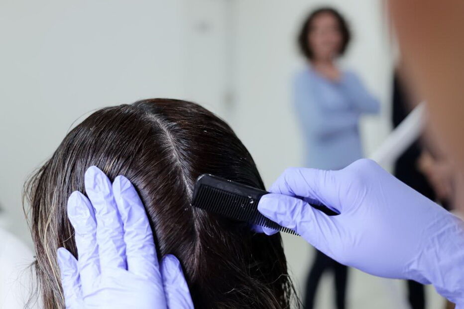 Clínicas de tratamento para piolhos cheias de adolescentes contagiadas em 'selfies'