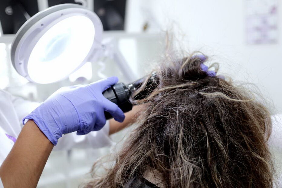 Clínicas de tratamento para piolhos cheias de adolescentes contagiadas em 'selfies'