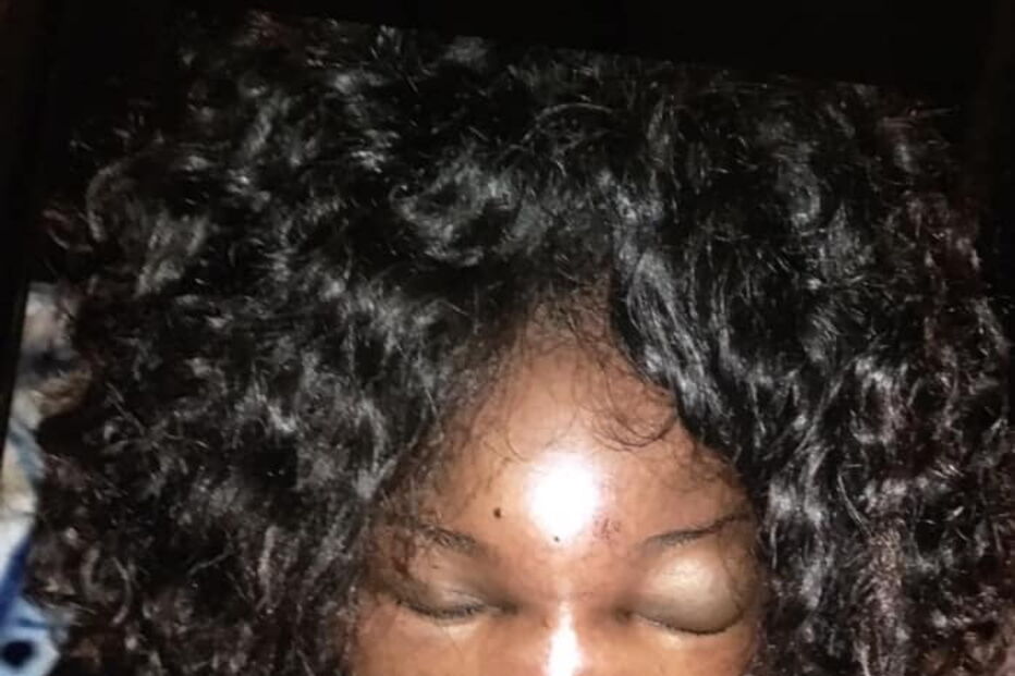 Mulher queixa-se de ter sido agredida pela PSP na Amadora