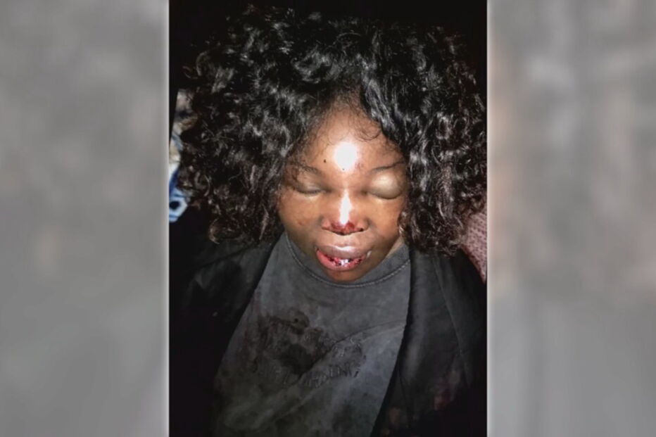 Mulher acusa PSP de a ter espancado em frente à filha de 8 anos na Amadora