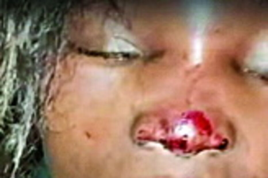 Cláudia Simões foi hospitalizada, assim como o PSP 