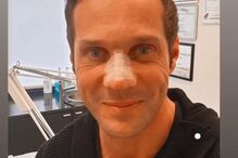 José Carlos Pereira logo após a rinoplastia.JPG