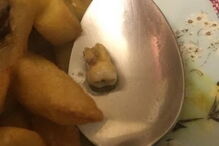 Restaurante chinês serve refeição com dente humano e mantém boa classificação de higiene