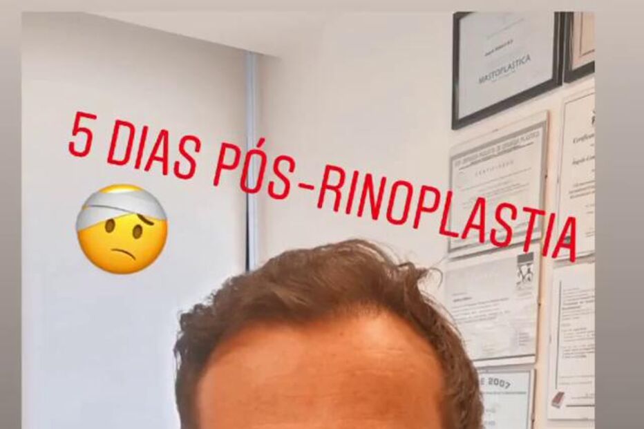 José Carlos Pereira logo após a rinoplastia.JPG