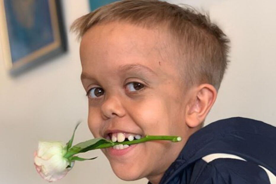 Menino que implorou pela morte após ser alvo de bullying volta a sorrir. Mundo envia mensagens de solidariedade