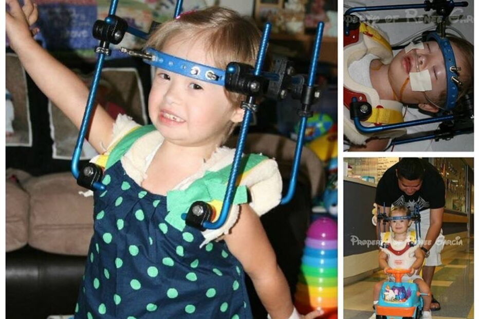 Menina com síndrome de Down torna-se modelo anos após médicos sugerirem que fosse dada para adoção