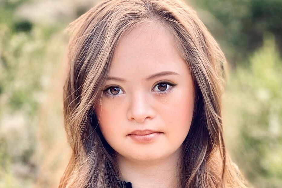 Menina com síndrome de Down torna-se modelo anos após médicos sugerirem que fosse dada para adoção