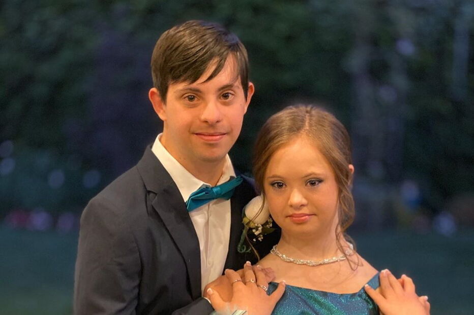 Menina com síndrome de Down torna-se modelo anos após médicos sugerirem que fosse dada para adoção