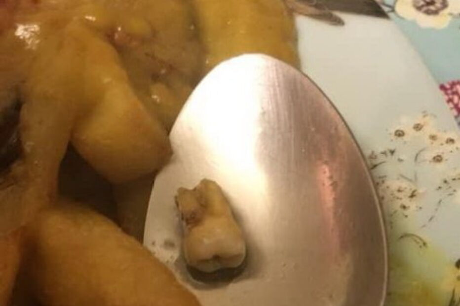 Restaurante chinês serve refeição com dente humano e mantém boa classificação de higiene