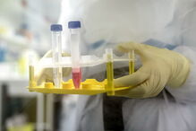 Remdesivir, o medicamento que está a salvar a vida a infetados com coronavírus