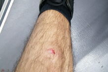 Militar da GNR agredido com garrafa ao tentar terminar festa durante Estado de Emergência