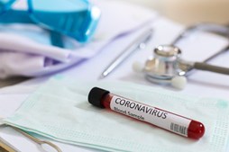 Teste coronavírus
