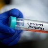 Autoridades britânicas investigam incidência do coronavírus em comunidades étnicas