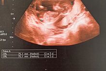 William Carvalho mostra ecografia do filho