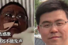 Pele de médicos infetados por Covid-19 muda de cor e intriga autoridades de saúde