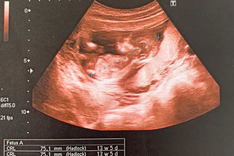 William Carvalho mostra ecografia do filho