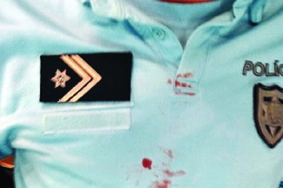 Polícia foi golpeado no tórax em Carcavelos