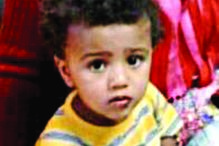 Henrique e Raphael foram queimados pela mãe