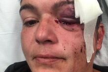 Linda Tirado, fotógrafa ferida