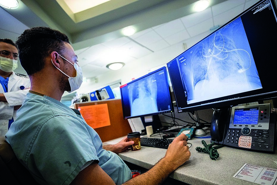 O vírus ataca vários órgãos, desde o cérebro aos olhos, pulmões, coração, vasos sanguíneos, rins, fígado e intestinos 