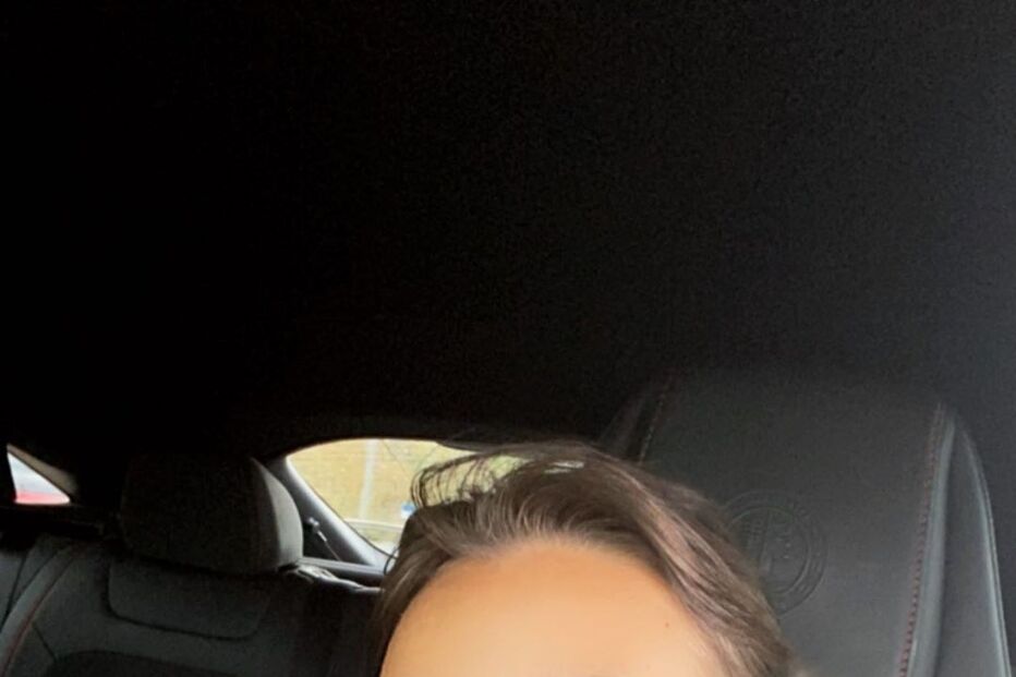 April Ivy contou que se magoou no dedo