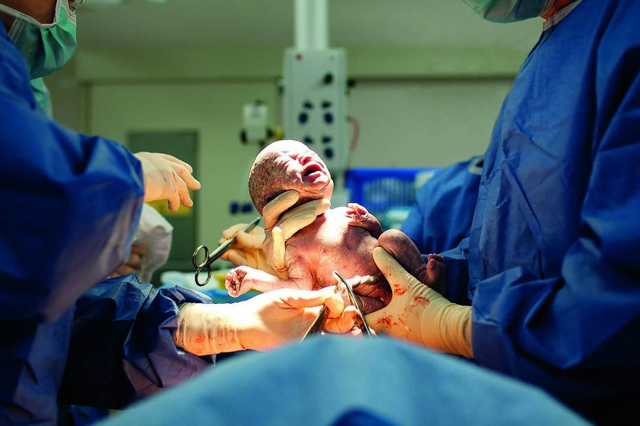 Parto deve ocorrer num bloco de partos com pressão negativa, dedicado a casos suspeitos ou confirmados de Covid-19