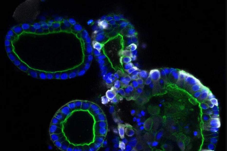 Covid-19 no intestino 