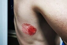 PSP mordido por cidadão com coronavírus no Cacém