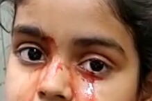 Menina de 11 anos chora lágrimas de sangue e médicos não encontram explicação