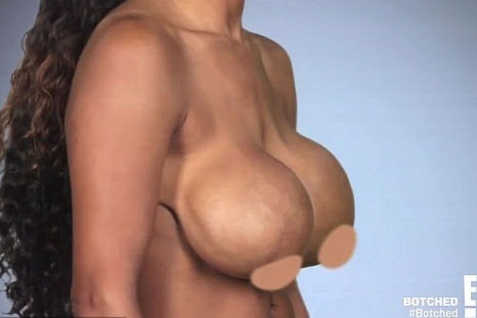 Tia mostra o resultado de duas cirurgias mal feitas