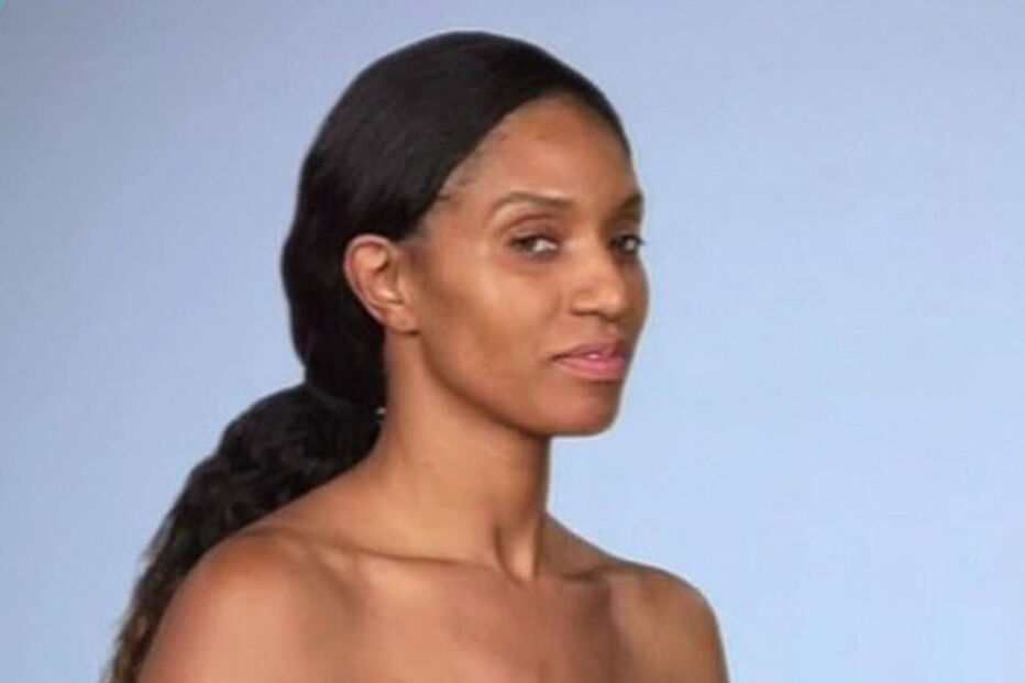 Tia mostra o resultado de duas cirurgias mal feitas