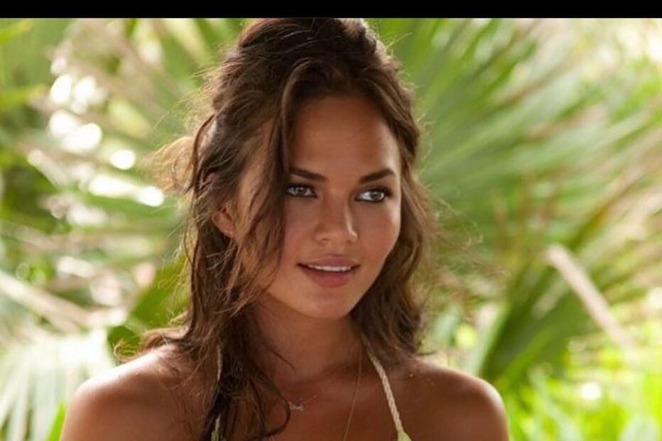 Chrissy Teigen antes de remover o silicone no peito