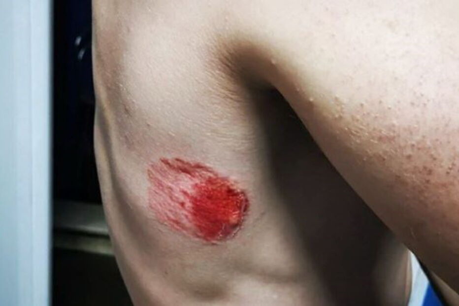 PSP mordido por cidadão com coronavírus no Cacém