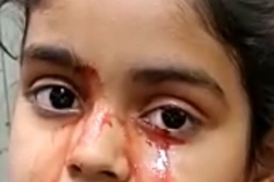 Menina de 11 anos chora lágrimas de sangue e médicos não encontram explicação