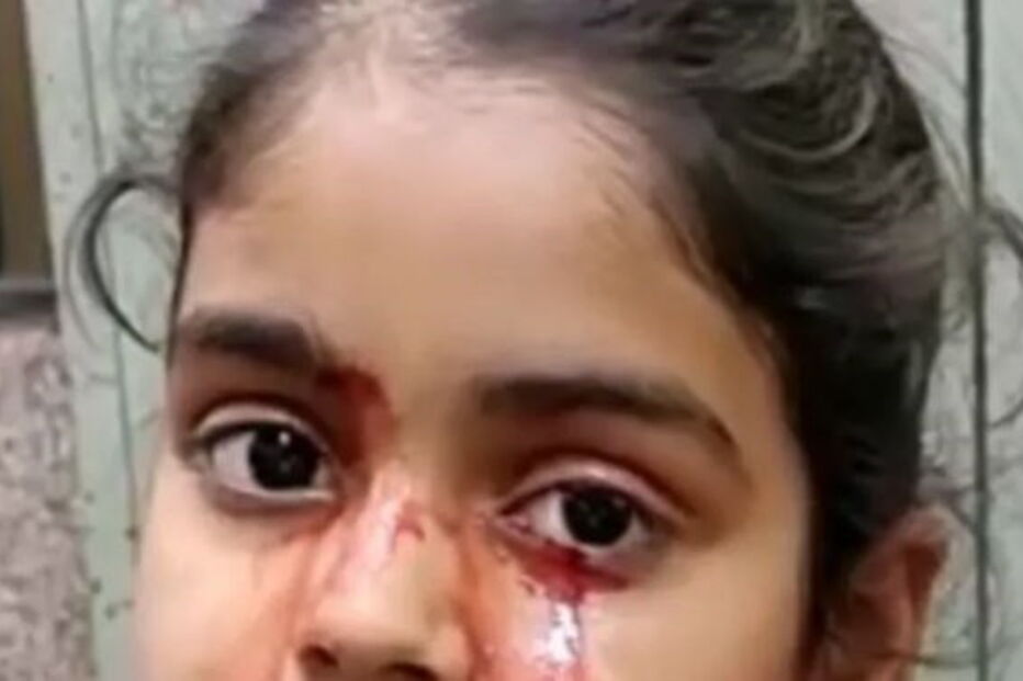 Menina de 11 anos chora lágrimas de sangue e médicos não encontram explicação