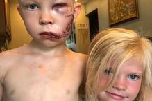 Iva Domingues partilha história de amor de crianças