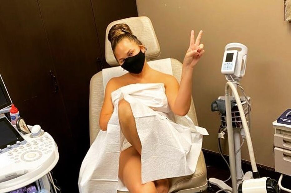 Chrissy Teigen retirou silicone do peito