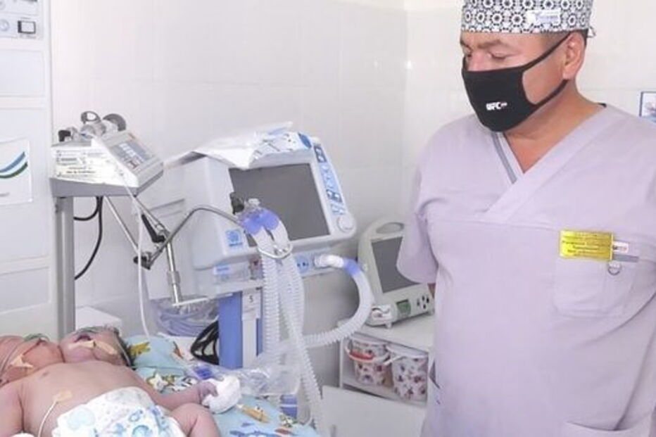 Bebé de duas cabeças nasceu no Uzebequistão