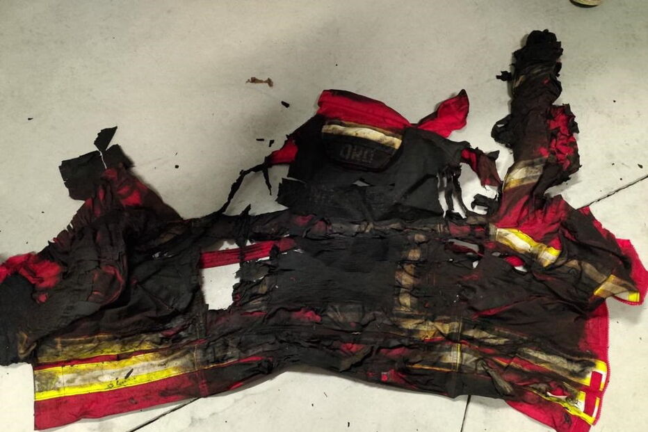 Fato de bombeiro que sofreu queimaduras em 95% do corpo ficou destruído