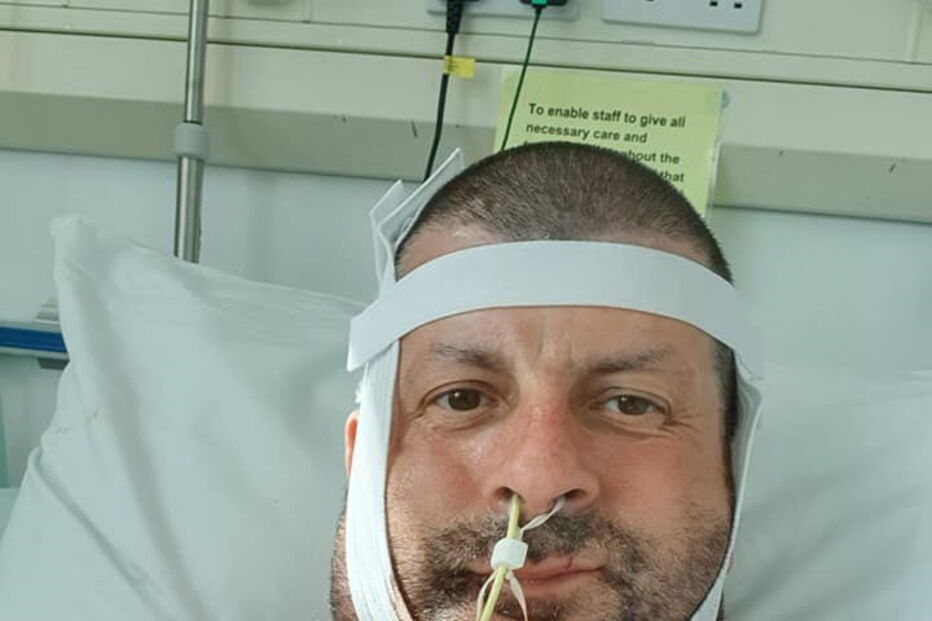 Darren tinha um tumor no maxilar