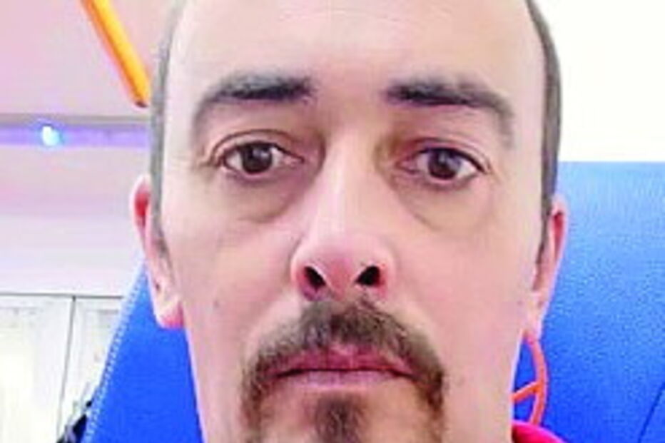 Carlos Carvalho, bombeiro de 40 anos, tem extensas queimaduras