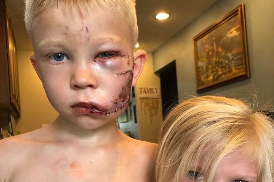 Iva Domingues partilha história de amor de crianças