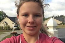 Menina de 15 anos em coma após ser atacada por dois cãos que lhe arrancaram o couro cabeludo