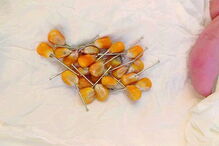 Alfinetes em milho têm sido encontrados no mercado e no cemitério 