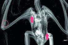 Projéteis ficaram alojados no corpo  