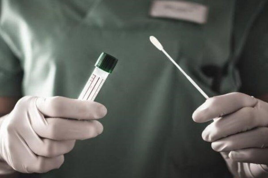  teste serológico coronavirus covid